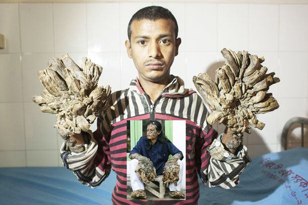 This Bazadar, Tree Man...