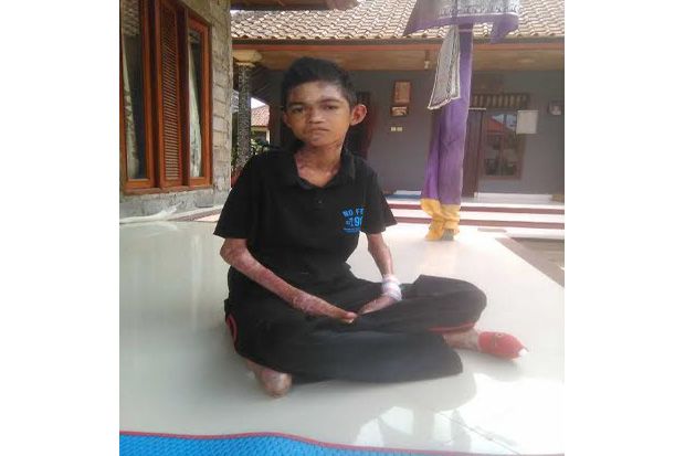 Remaja di Bali Idap...