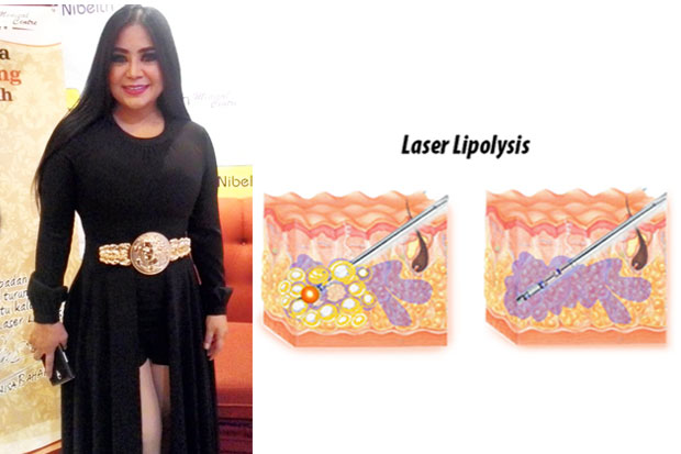 Lipolysis Laser, Make...