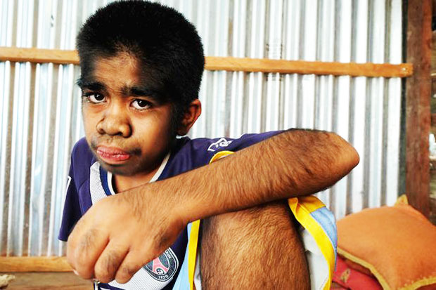Meet Raihan, Hairy Hanoman...