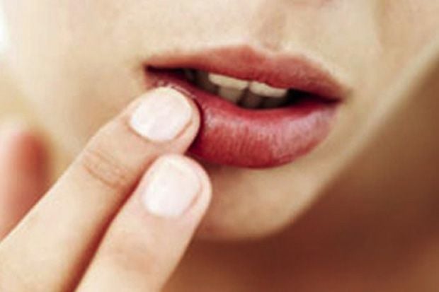 Atasi Bibir Kering Selama...