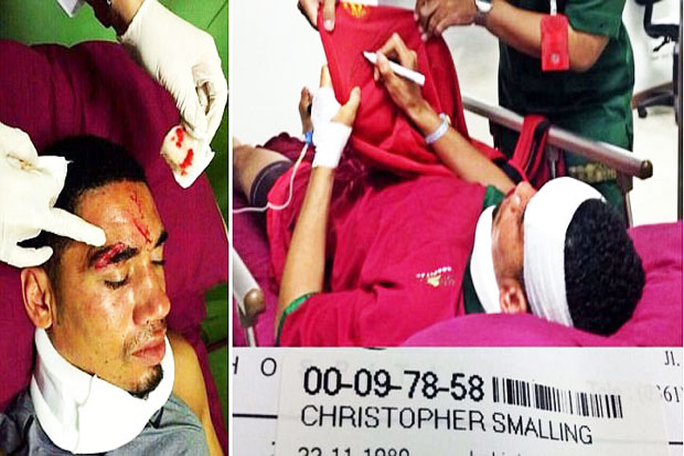 Nasty Cut Above Smalling...