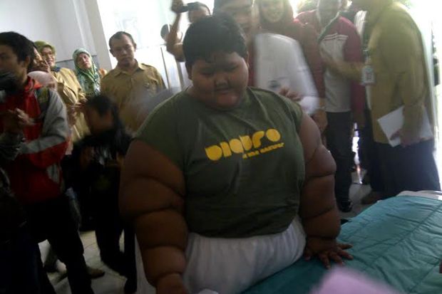 Bocah Obesitas Asal...