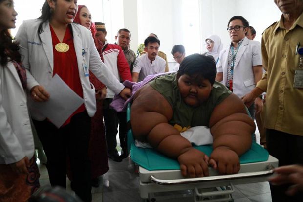 Arya si Bocah Obesitas...