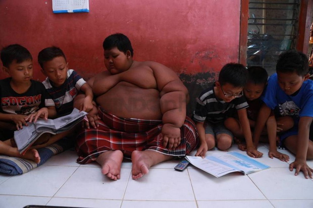 Arya Bocah Obesitas...