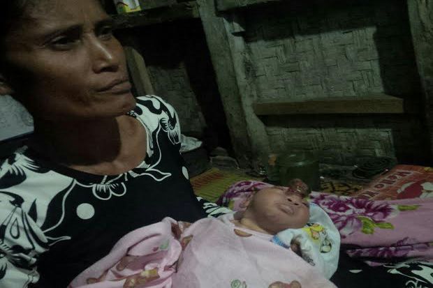 Tolong, Bayi Tanpa Tempurung...