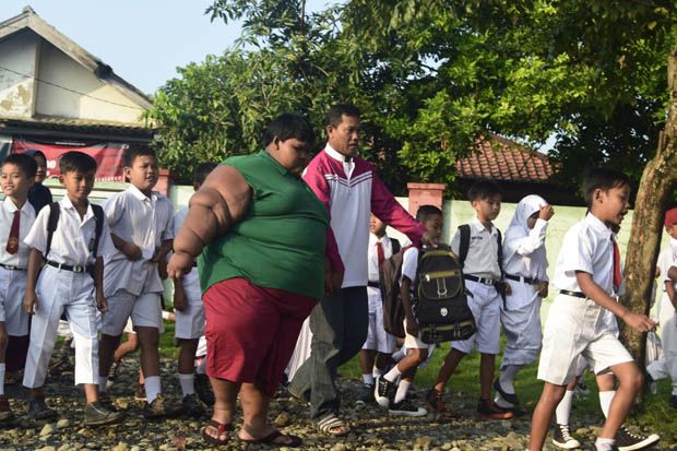 Arya Permana Bocah Obesitas...