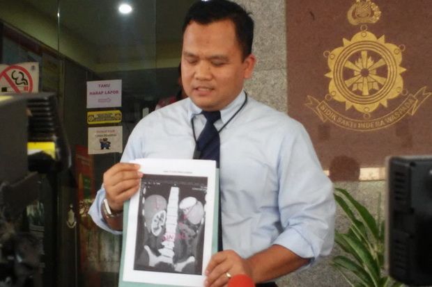 Bareskrim Tahan Mantan...