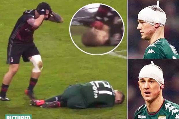 Wajah Joe Hart Berdarah-darah,...