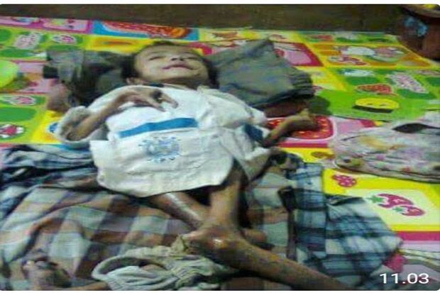 Alami Gizi Buruk, Remaja...