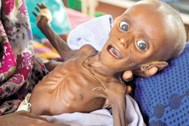 Kelaparan di Somalia,...