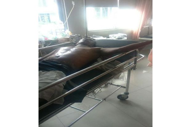Pasang Atap Rumah, Tubuh...
