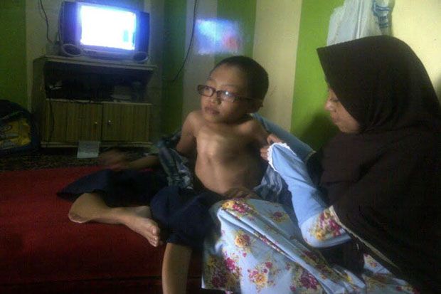 Miris, 20 Tulang Anak...