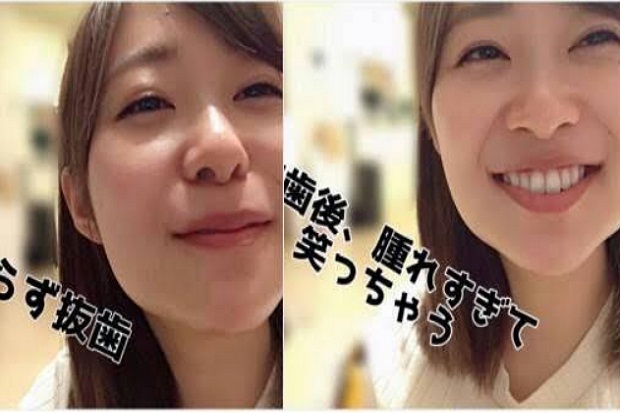 Alasan Sashihara Rino...