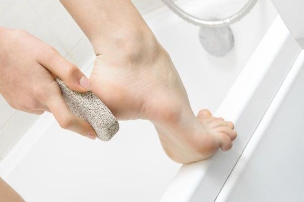 Cara Atasi Kulit Kaki...