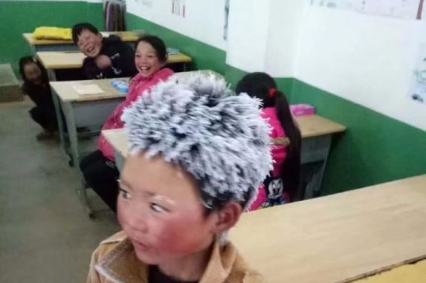 Bocah Berambut Es China...