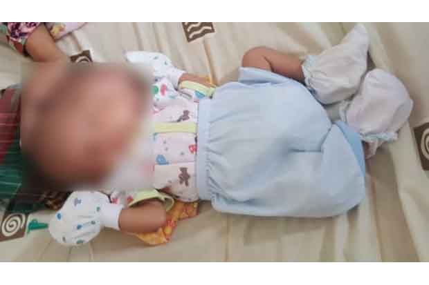 Tolong! Bayi Berwajah...