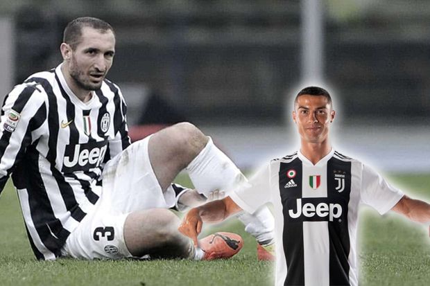 Chiellini Masih Belum...