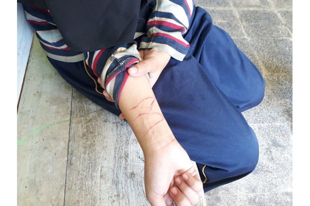 Luka Sayatan Masih Membekas,...