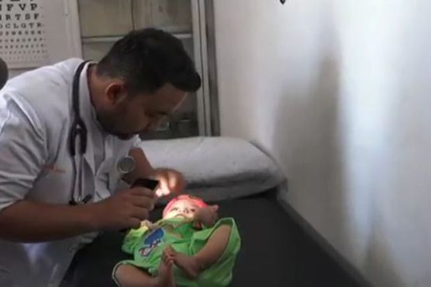 Terkena Virus Rubella,...