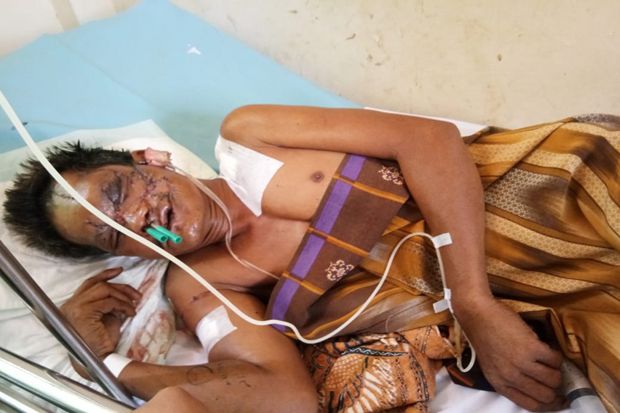 Suami Istri Luka Parah...