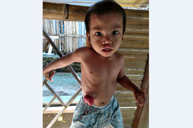 Butuh Bantuan Dermawan,...