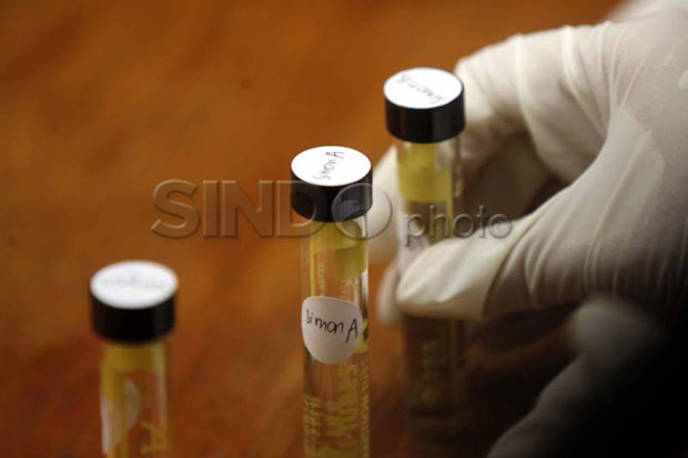 Hasil Tes Urine Artis...