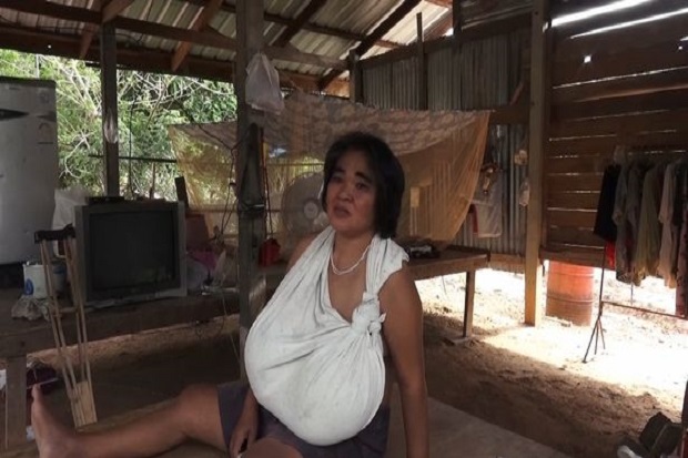 Payudara Terus Tumbuh...
