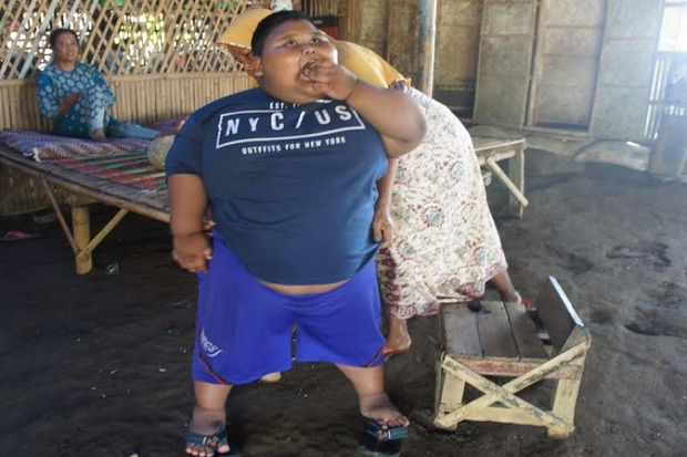 Obesitas, Bocah 7 Tahun...
