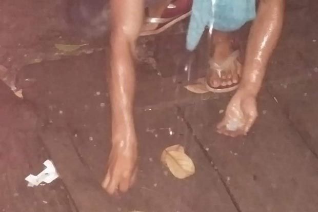 Hujan Es dan Angin Kencang...