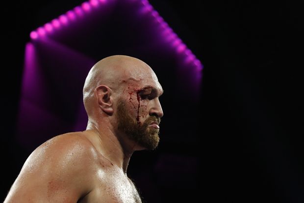 Tyson Fury Remehkan...