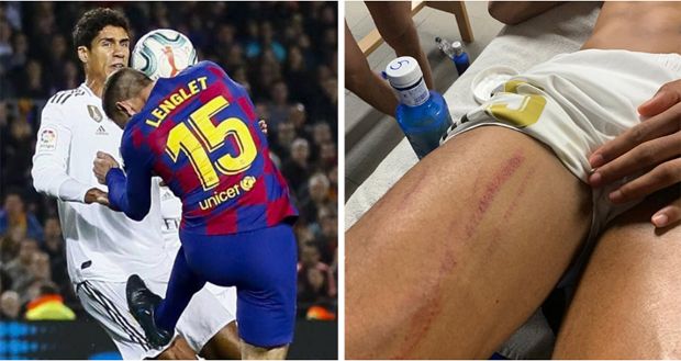Varane Dapat Tekel Horor,...