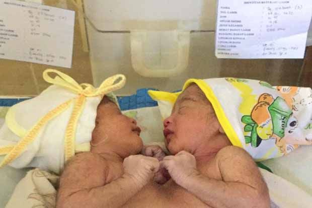 Bayi Kembar Dempet Dada...