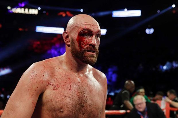 Fury Tak Peduli Wilder...