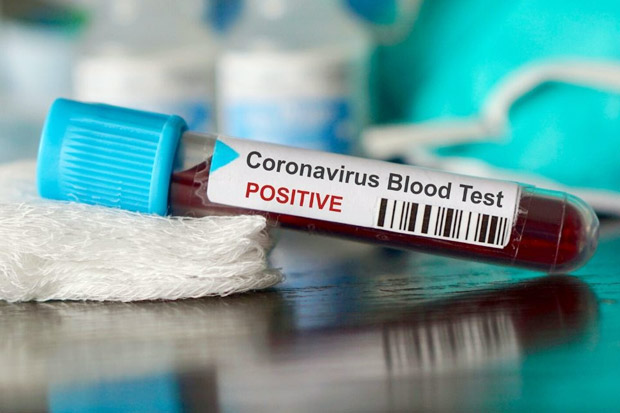 Terus Meluas, Virus...
