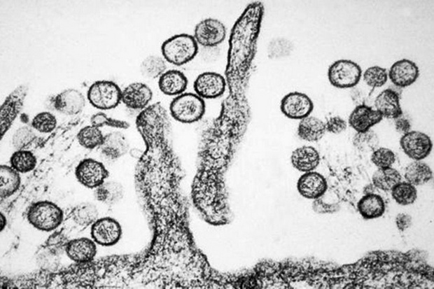 Bukan Virus Baru, Hantavirus...