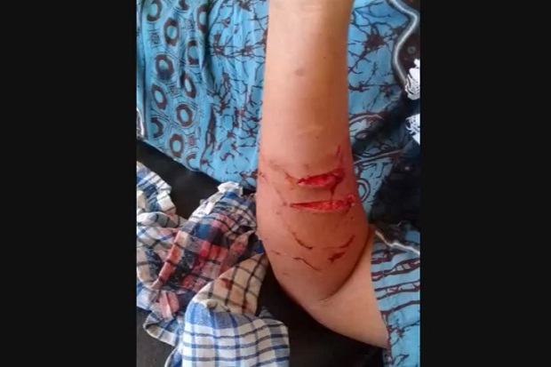 Buaya Muara Terkam Warga...