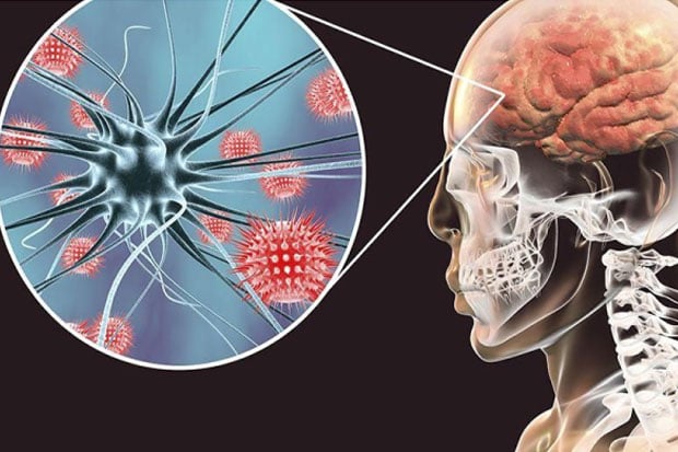 Penyakit Meningitis...