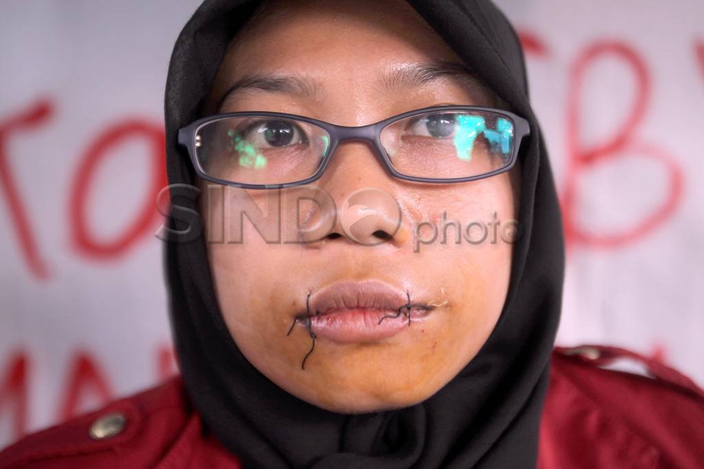 Aksi jahit mulut
