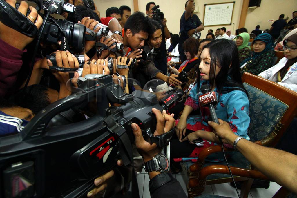 Setelah 17 kali operasi,...