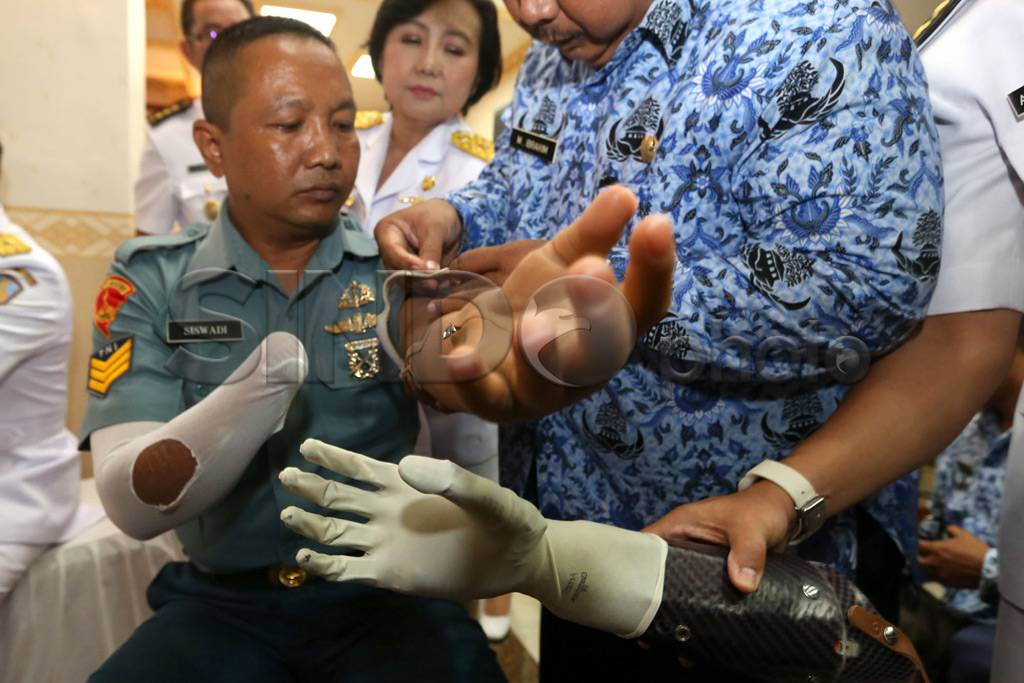 Pengguna Bionic Hand...