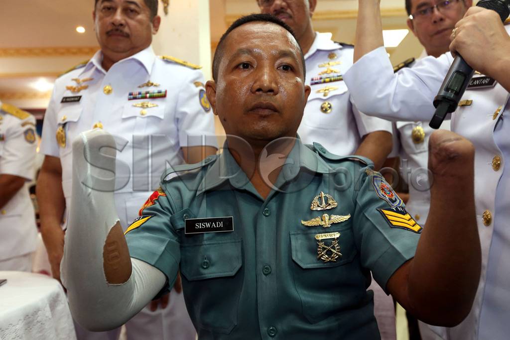 Pengguna Bionic Hand...